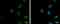 Serpin Family B Member 2 antibody, GTX103194, GeneTex, Immunofluorescence image 
