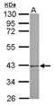 Proteasome 26S Subunit, Non-ATPase 7 antibody, LS-C155222, Lifespan Biosciences, Western Blot image 