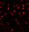 Calcium-transporting ATPase type 2C member 2 antibody, GTX32009, GeneTex, Immunocytochemistry image 