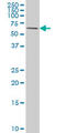 Receptor Interacting Serine/Threonine Kinase 2 antibody, LS-B10054, Lifespan Biosciences, Western Blot image 