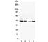 Vascular Endothelial Growth Factor D antibody, R30396, NSJ Bioreagents, Western Blot image 