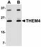 Thioesterase Superfamily Member 4 antibody, orb75222, Biorbyt, Western Blot image 