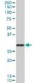 Serine Protease 2 antibody, H00005645-B01P, Novus Biologicals, Western Blot image 