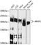 ArfGAP With RhoGAP Domain, Ankyrin Repeat And PH Domain 1 antibody, A06167, Boster Biological Technology, Western Blot image 