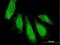 Ubiquitin Associated Protein 1 antibody, H00051271-B01P, Novus Biologicals, Immunocytochemistry image 