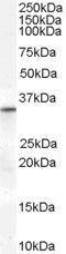 Voltage Dependent Anion Channel 2 antibody, GTX89279, GeneTex, Western Blot image 