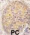 Calcium/Calmodulin Dependent Protein Kinase Kinase 2 antibody, abx033190, Abbexa, Western Blot image 