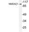 Glutamate Ionotropic Receptor NMDA Type Subunit 1 antibody, LS-C177755, Lifespan Biosciences, Western Blot image 