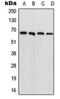 Phenylalanyl-TRNA Synthetase Subunit Beta antibody, orb214957, Biorbyt, Western Blot image 