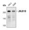 Lysine Demethylase 3B antibody, PA5-17170, Invitrogen Antibodies, Western Blot image 
