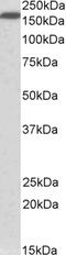 Isocitrate Dehydrogenase (NAD(+)) 3 Beta antibody, 42-380, ProSci, Enzyme Linked Immunosorbent Assay image 