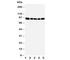 Oxysterol-binding protein 1 antibody, R31051, NSJ Bioreagents, Western Blot image 