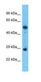Trafficking Protein Particle Complex 10 antibody, orb330446, Biorbyt, Western Blot image 