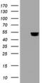 Thymidine Phosphorylase antibody, NBP2-45397, Novus Biologicals, Western Blot image 