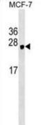 Heme Binding Protein 1 antibody, abx029400, Abbexa, Western Blot image 