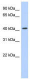 Nuclear Receptor Subfamily 1 Group H Member 2 antibody, TA333896, Origene, Western Blot image 