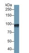 ADF antibody, LS-C314173, Lifespan Biosciences, Western Blot image 