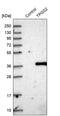 Tubulin Polyglutamylase Complex Subunit 2 antibody, PA5-59214, Invitrogen Antibodies, Western Blot image 