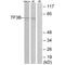 BRF1 RNA Polymerase III Transcription Initiation Factor Subunit antibody, MBS9402512, MyBioSource, Western Blot image 