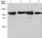 Actinin Alpha 4 antibody, LS-C404706, Lifespan Biosciences, Western Blot image 