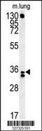 Reticulocalbin 3 antibody, 62-049, ProSci, Western Blot image 