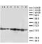 Cytokine Inducible SH2 Containing Protein antibody, LS-C312931, Lifespan Biosciences, Western Blot image 