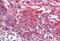 Frizzled Class Receptor 4 antibody, MBS244159, MyBioSource, Immunohistochemistry paraffin image 