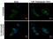 Sequestosome 1 antibody, GTX629888, GeneTex, Immunofluorescence image 