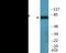 Microtubule Associated Protein Tau antibody, EKC2527, Boster Biological Technology, Western Blot image 