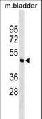 Actopaxin antibody, LS-C158235, Lifespan Biosciences, Western Blot image 