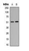 Gamma-aminobutyric acid receptor subunit alpha-6 antibody, orb393057, Biorbyt, Western Blot image 