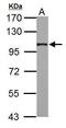 Adaptor Related Protein Complex 2 Subunit Beta 1 antibody, GTX112479, GeneTex, Western Blot image 
