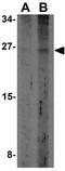 TNF Receptor Superfamily Member 12A antibody, GTX31747, GeneTex, Western Blot image 