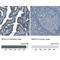 Mesothelin antibody, NBP1-88224, Novus Biologicals, Immunohistochemistry paraffin image 
