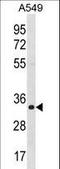 Enoyl-CoA Hydratase 1 antibody, LS-C159505, Lifespan Biosciences, Western Blot image 