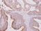 Tubulin Beta 2A Class IIa antibody, GTX101863, GeneTex, Immunohistochemistry paraffin image 