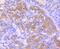 Insulin Like Growth Factor 2 antibody, NBP2-67915, Novus Biologicals, Immunohistochemistry paraffin image 
