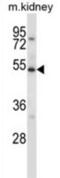 Unc-51 Like Kinase 3 antibody, abx027408, Abbexa, Western Blot image 