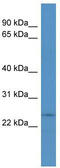 Cysteine And Histidine Rich 1 antibody, TA329246, Origene, Western Blot image 