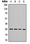 TIMP Metallopeptidase Inhibitor 1 antibody, orb315820, Biorbyt, Western Blot image 