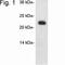 Caveolin 1 antibody, NB300-509, Novus Biologicals, Western Blot image 