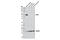 Acid Phosphatase, Prostate antibody, 12861S, Cell Signaling Technology, Western Blot image 