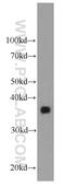 Clusterin antibody, 66109-1-Ig, Proteintech Group, Western Blot image 