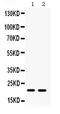 GPx-4 antibody, PB9625, Boster Biological Technology, Western Blot image 