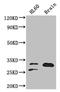 Triosephosphate Isomerase 1 antibody, CSB-PA13499A0Rb, Cusabio, Western Blot image 