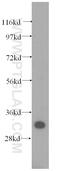 Sulfotransferase Family 1A Member 1 antibody, 60076-1-Ig, Proteintech Group, Western Blot image 