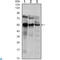 ETS Variant 5 antibody, LS-C812591, Lifespan Biosciences, Western Blot image 