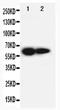 Interleukin 2 Receptor Subunit Beta antibody, PA5-79494, Invitrogen Antibodies, Western Blot image 