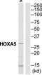 Homeobox A5 antibody, TA314024, Origene, Western Blot image 
