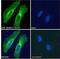 Roundabout Guidance Receptor 1 antibody, 46-315, ProSci, Western Blot image 